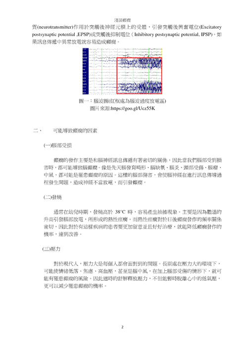 淺談癲癇